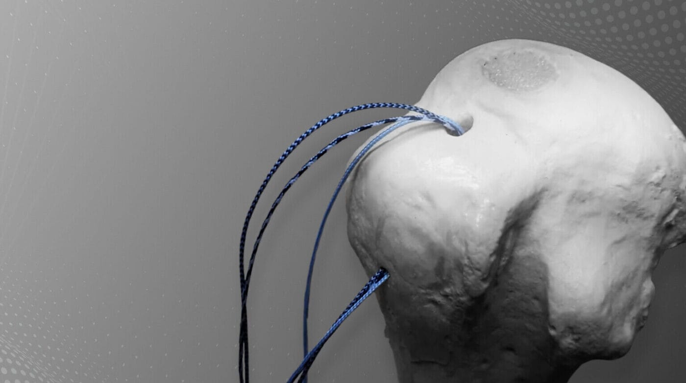 3D animace a videa z operací